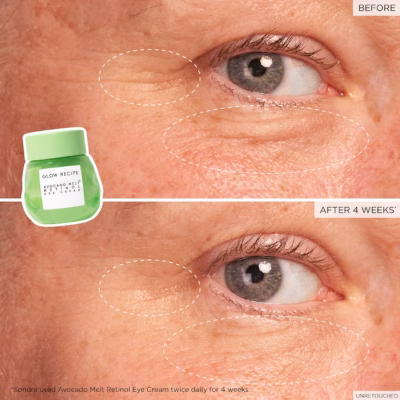 MODUM-850001316279_4 Glow Recipe mascarilla de ojos con aguacate y retinol — tratamiento nocturno antiarrugas y antiojeras.