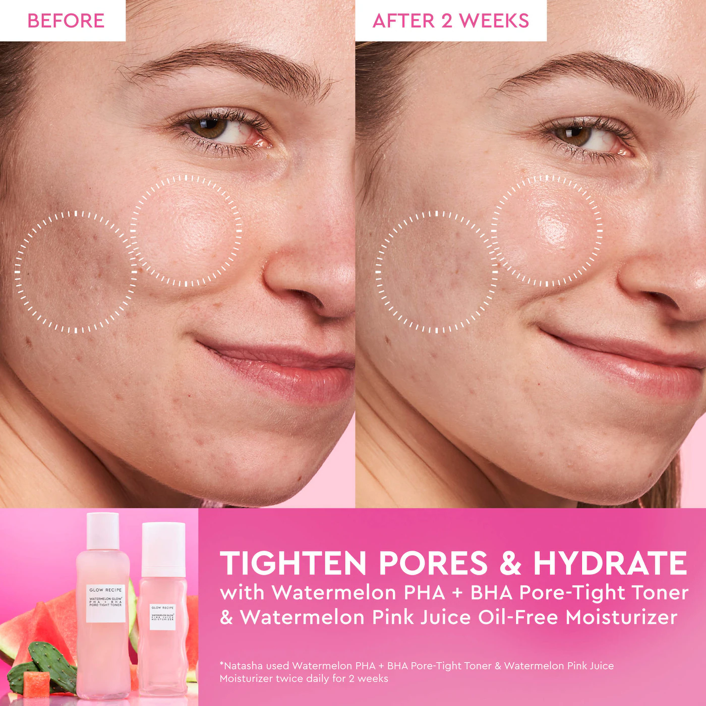 Glow Recipe Watermelon Glow PHA + BHA Pore-Tight Toner – 40 ml 2 Modum modelando su rostro antes y después de usar durante 2 semanas el Glow Recipe Watermelon PHA + BHA Pore-Tight Toner y el Watermelon Pink Juice Oil-Free Moisturizer, mostrando poros visiblemente más refinados e hidratación en la piel sobre fondo rosado, junto a las botellas de ambos productos.